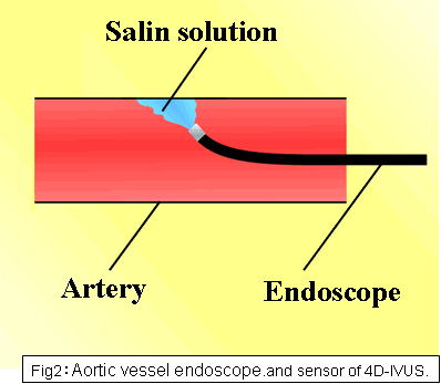 Develop new and practical diagnostic technology for site and severity of arteriosclerosis