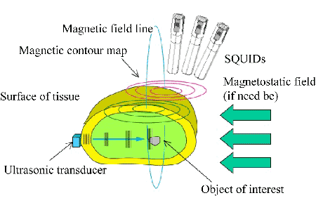 Activated Magnetometry Utilizing SQUID Efficacy 