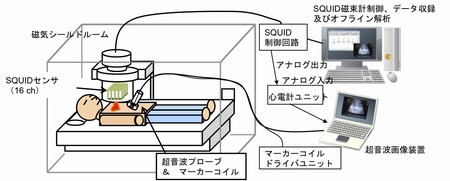 研究開発：SQUIDを用いた能動的磁気イメージング